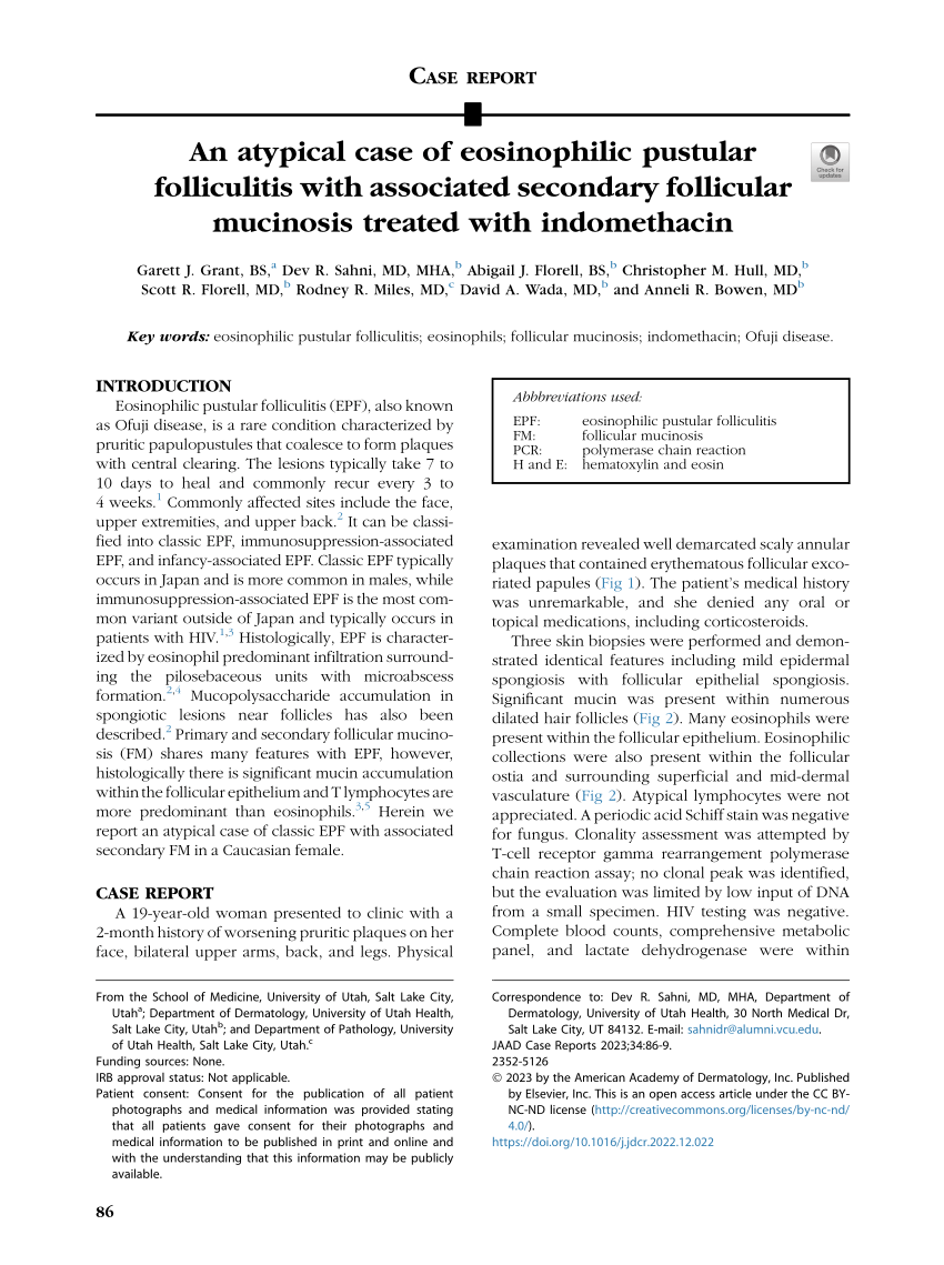 Pdf An Atypical Case Of Eosinophilic Pustular Folliculitis With Associated Secondary 