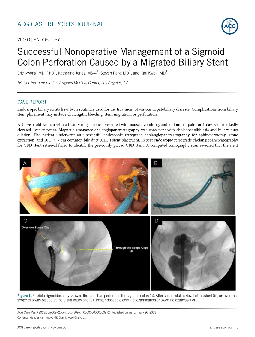 Pdf Successful Nonoperative Management Of A Sigmoid Colon Perforation Caused By A Migrated 0871