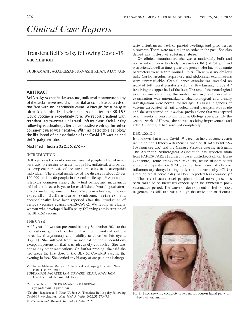 F ig 1. Principle of facial pacing for unilateral facial paralysis.