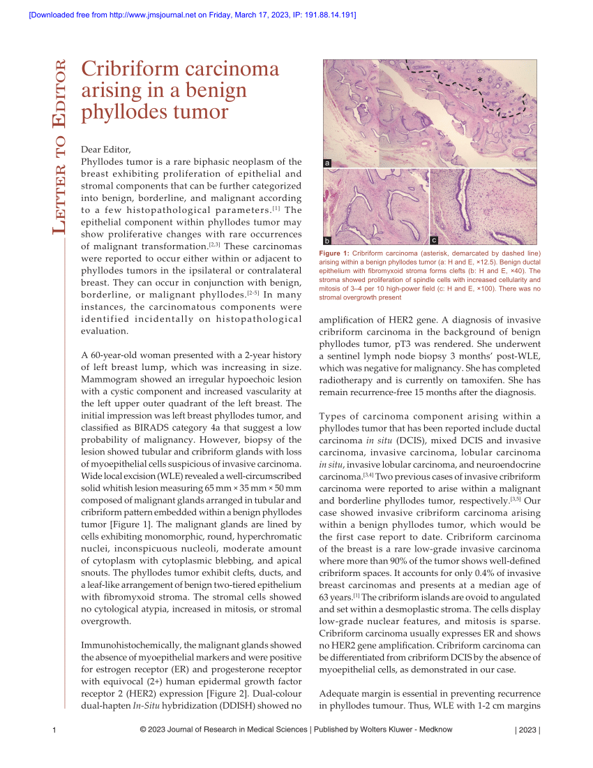 thesis on phyllodes tumor