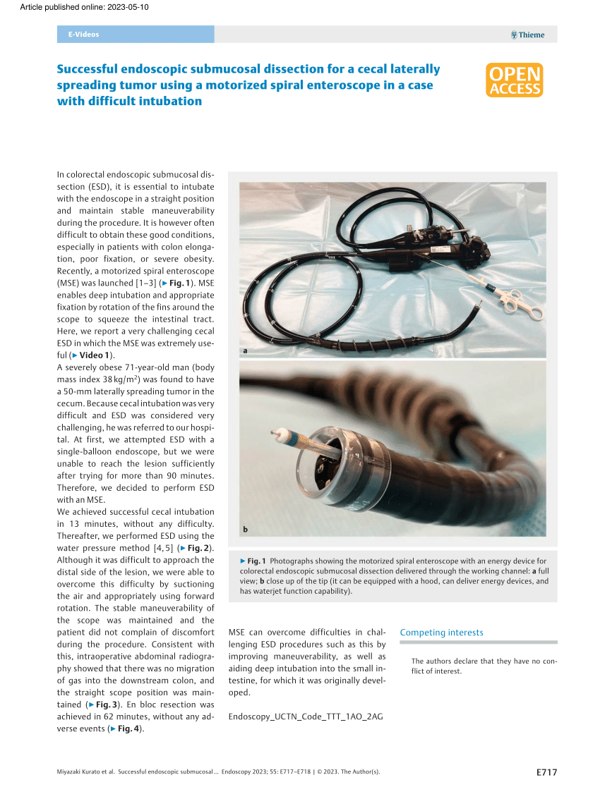 Pdf Successful Endoscopic Submucosal Dissection For A Cecal Laterally Spreading Tumor Using A 3979