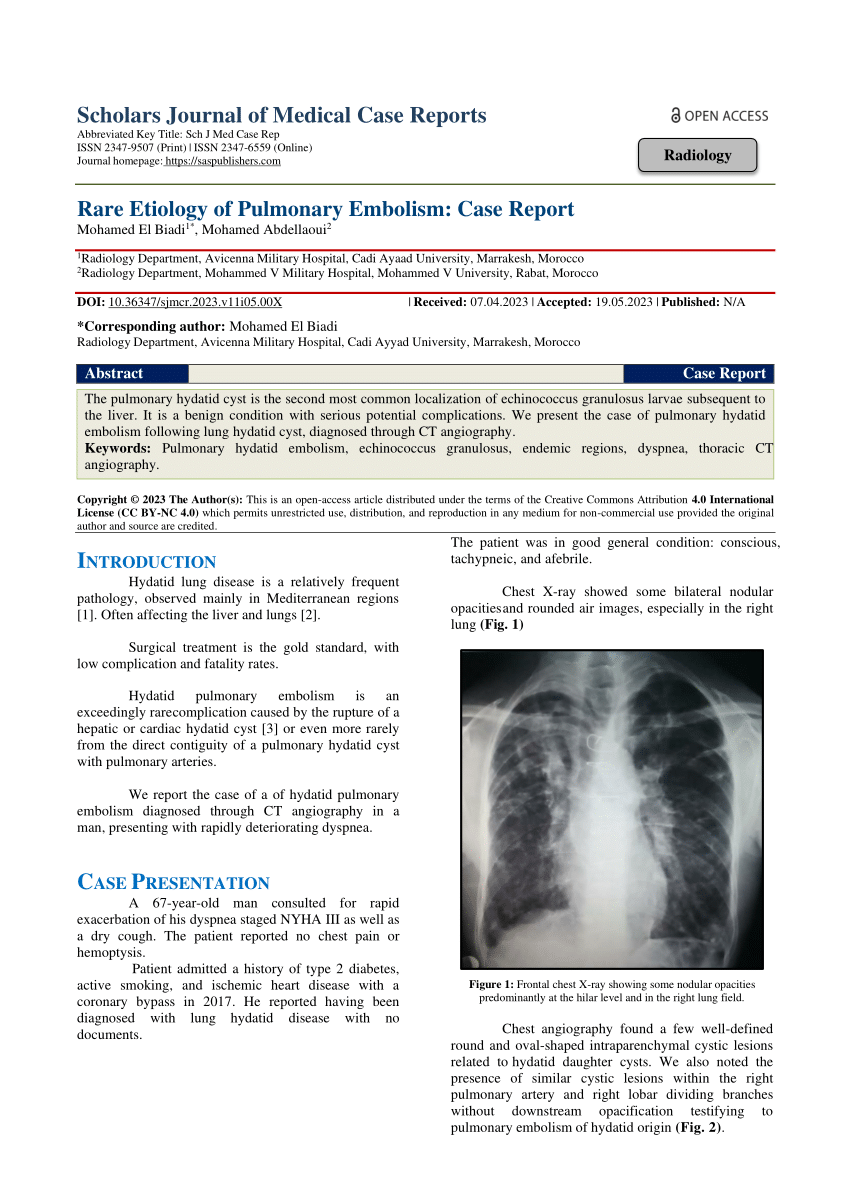 case study of patient with pulmonary embolism