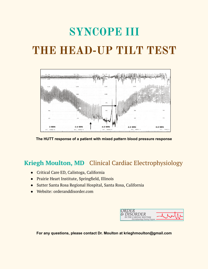 What is head up tilt test (HUTT)? - All About Heart And Blood Vessels