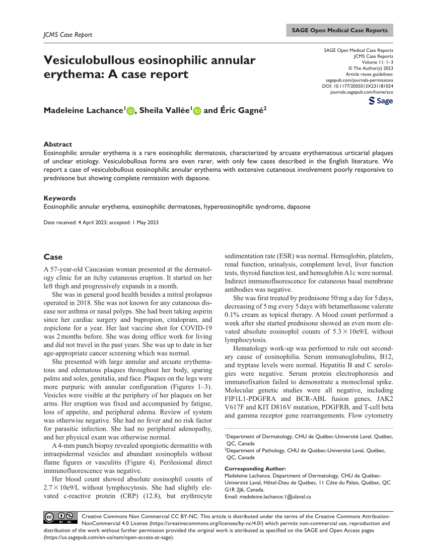 (PDF) Vesiculobullous eosinophilic annular erythema: A case report