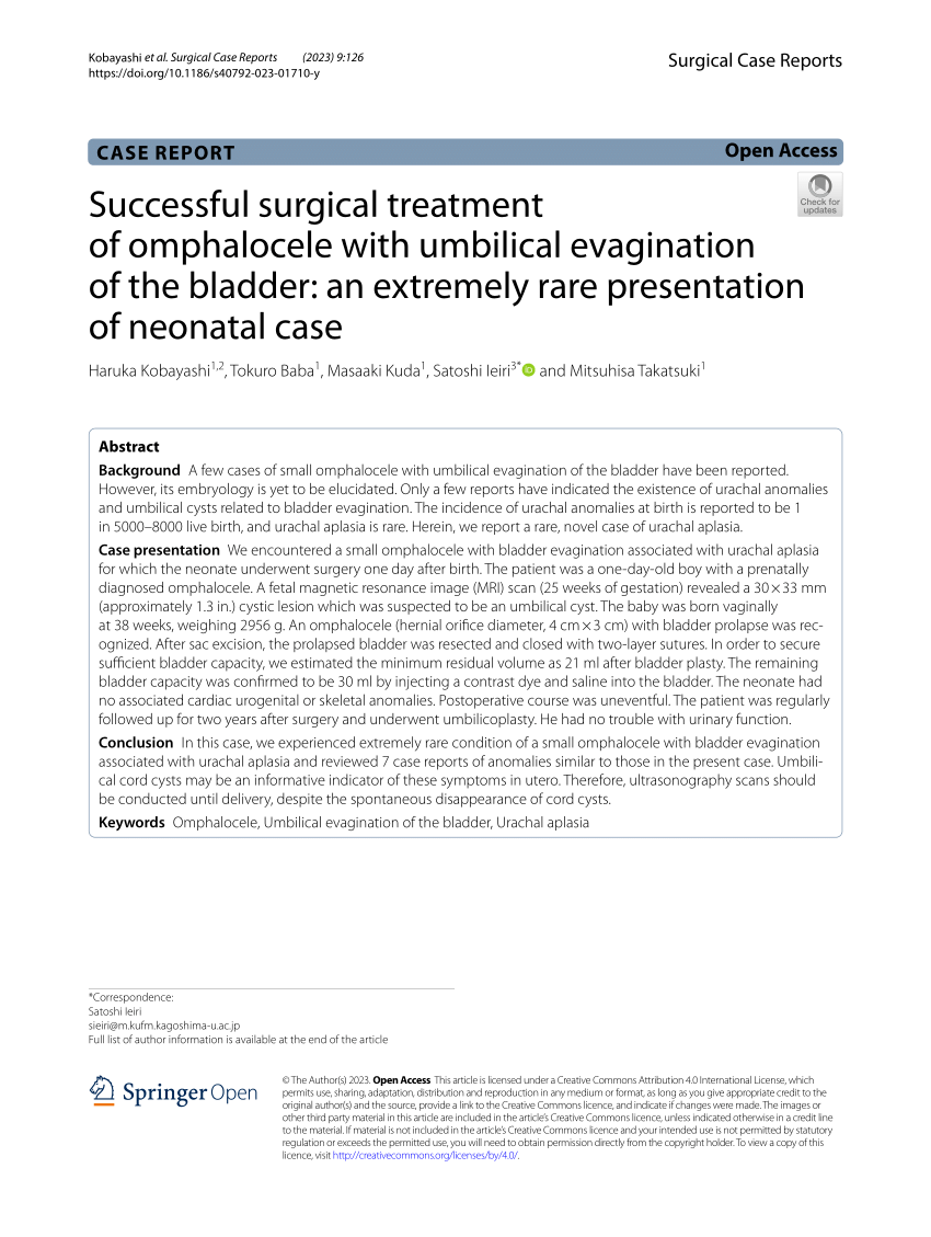 Picture of umbilical cord hernia associated with complete evagination