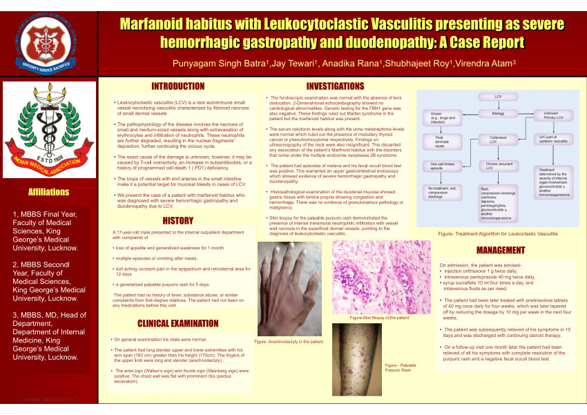 (PDF) Marfanoid habitus with Leukocytoclastic Vasculitis presenting as ...