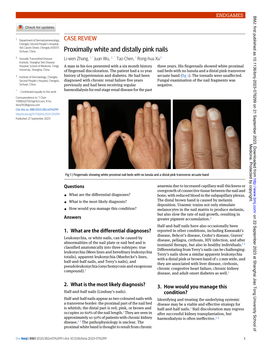 a,b) Unilateral onycholysis of the nails of the left foot (with... |  Download Scientific Diagram