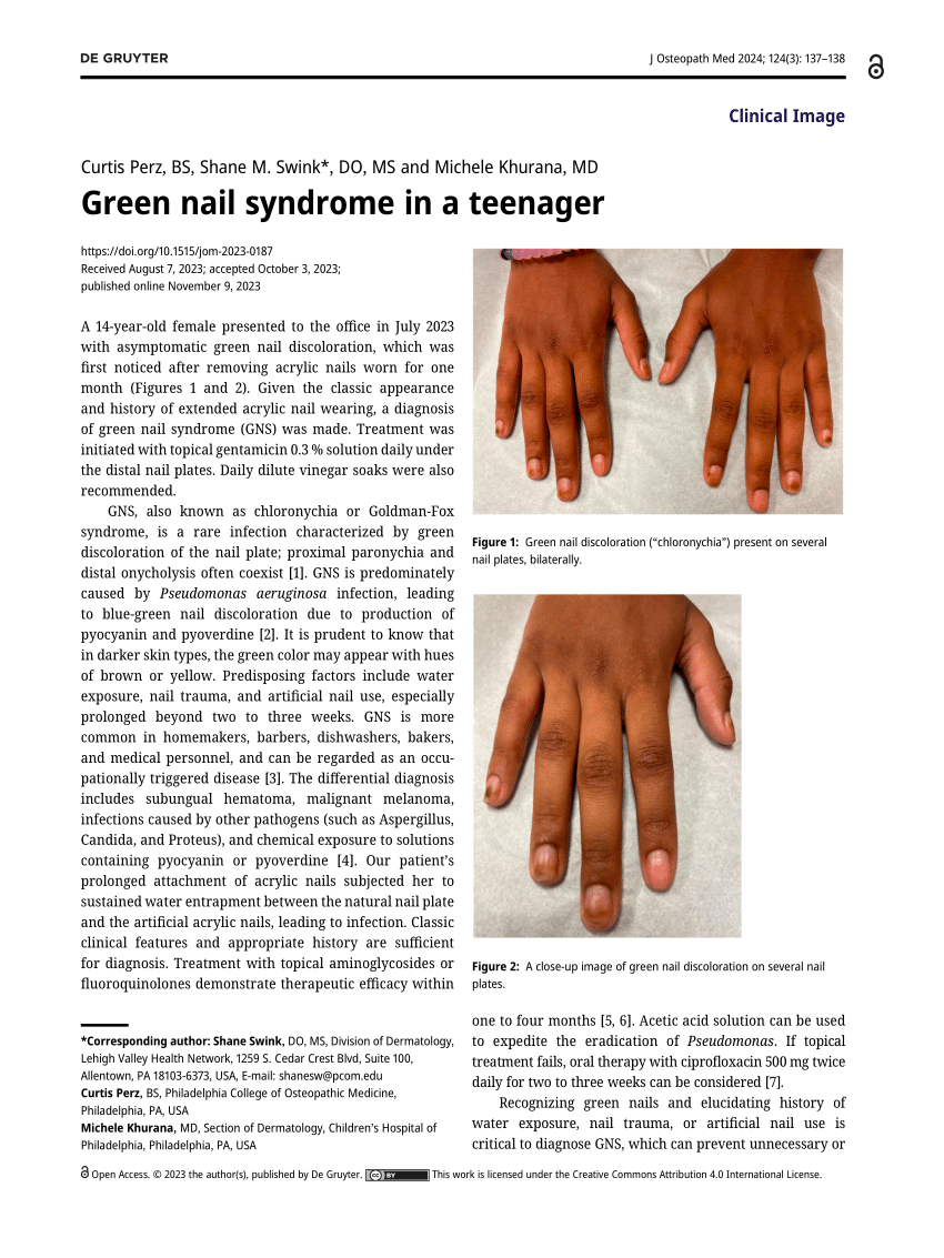 Paronychia chronic - Altmeyers Encyclopedia - Department Dermatology
