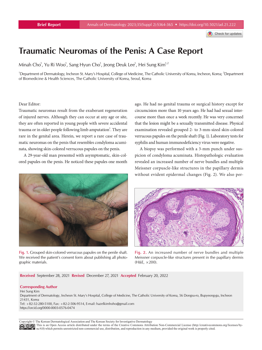 PDF Traumatic Neuromas of the Penis A Case Report