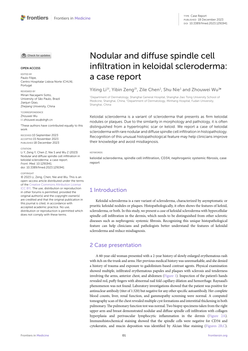 Frontiers  Nodular and diffuse spindle cell infiltration in