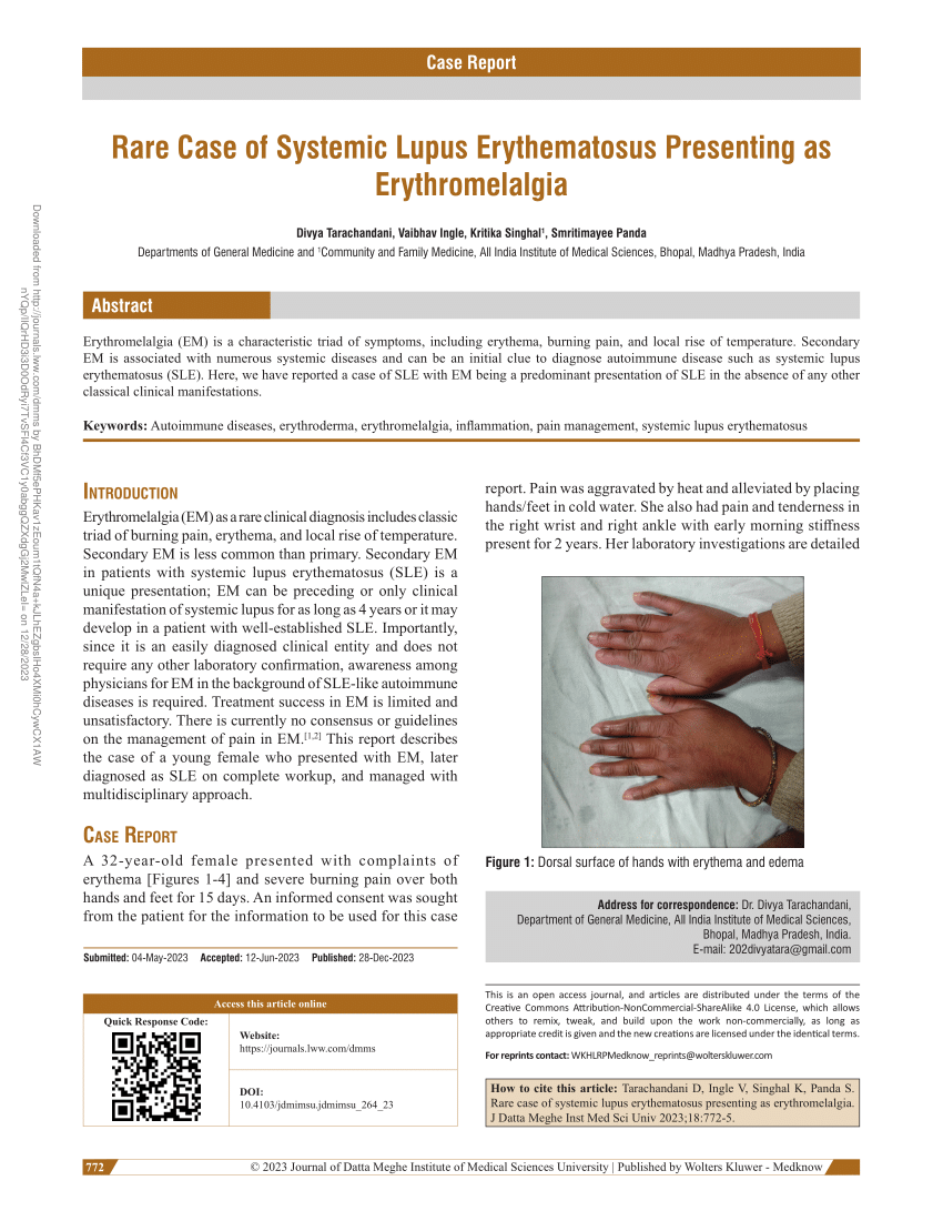 Pdf Case Report Rare Case Of Systemic Lupus Erythematosus Presenting