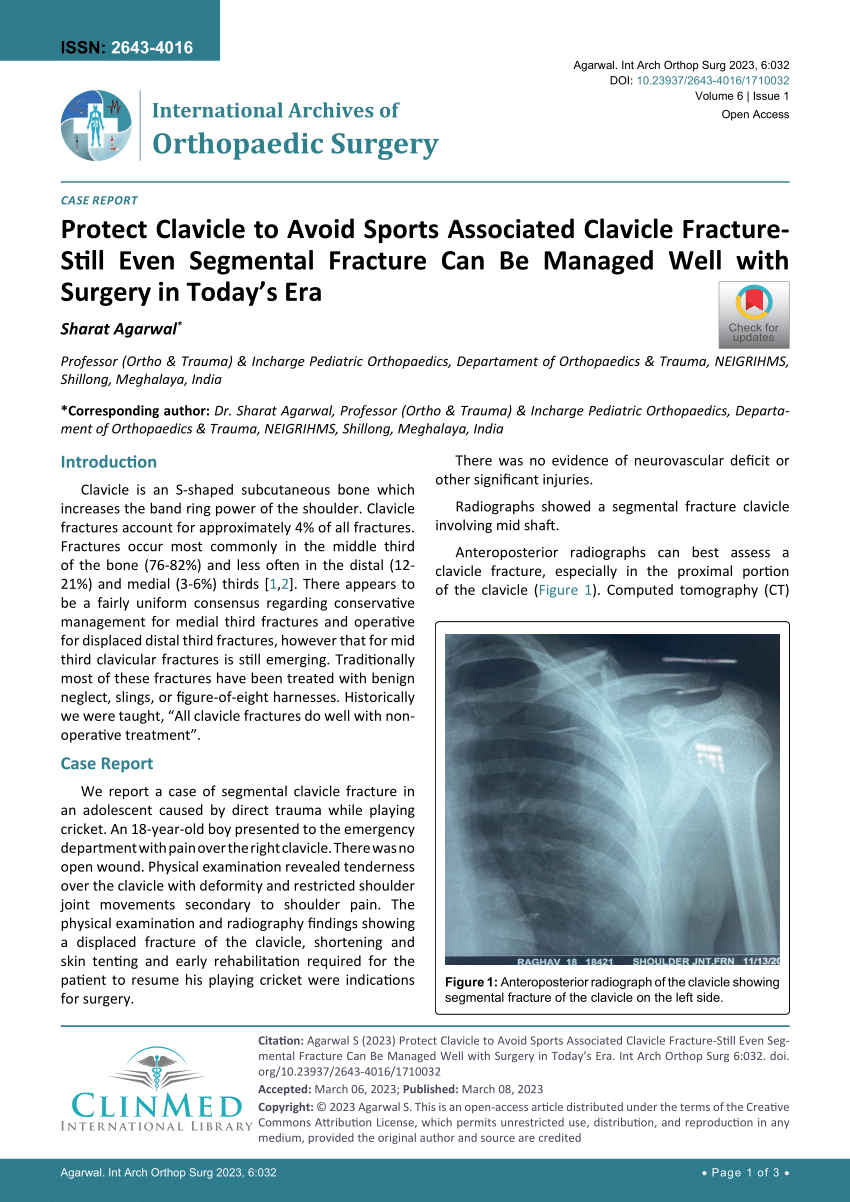(PDF) Protect Clavicle to Avoid Sports Associated Clavicle Fracture ...