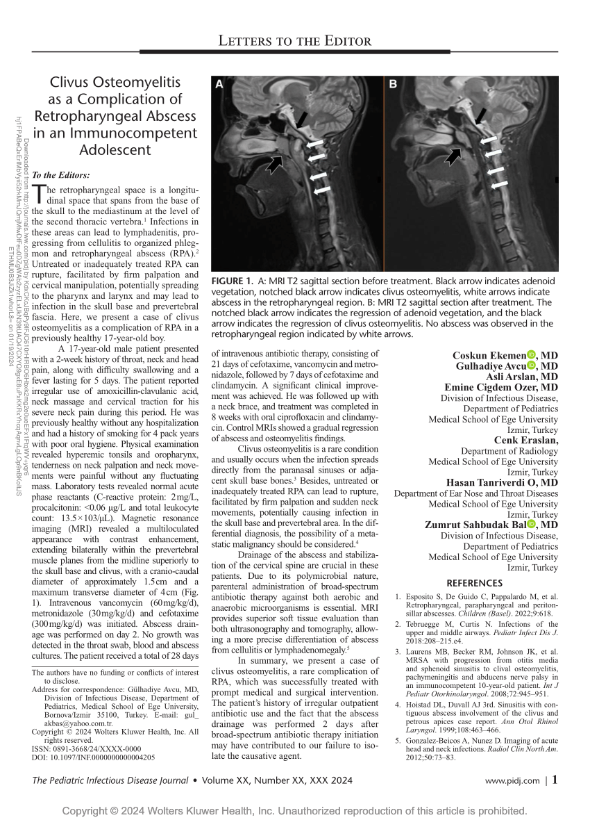 PDF Clivus Osteomyelitis as a Complication of Retropharyngeal  