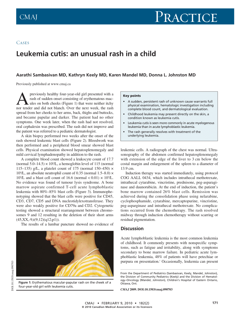 (PDF) Leukemia cutis: An unusual rash in a child