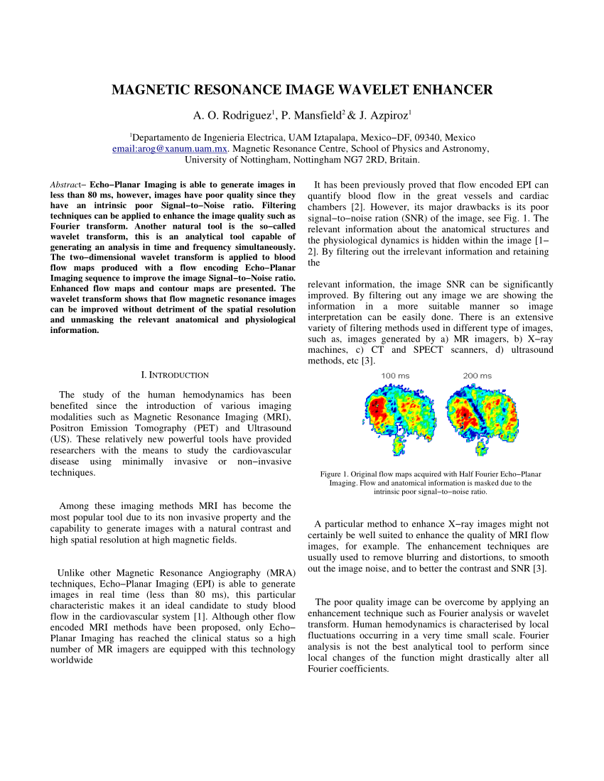 PDF) Magnetic resonance image wavelet enhancer