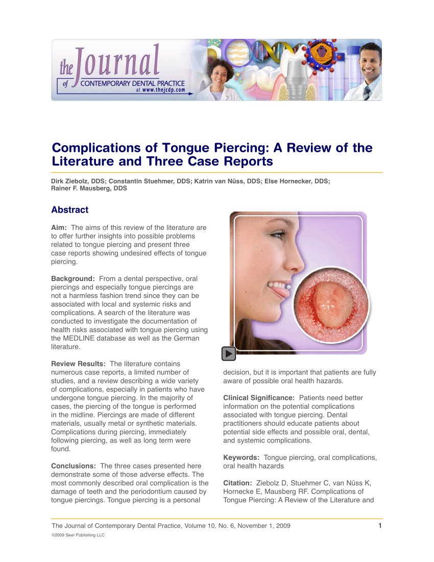 Pdf Complications Of Tongue Piercing A Review Of The