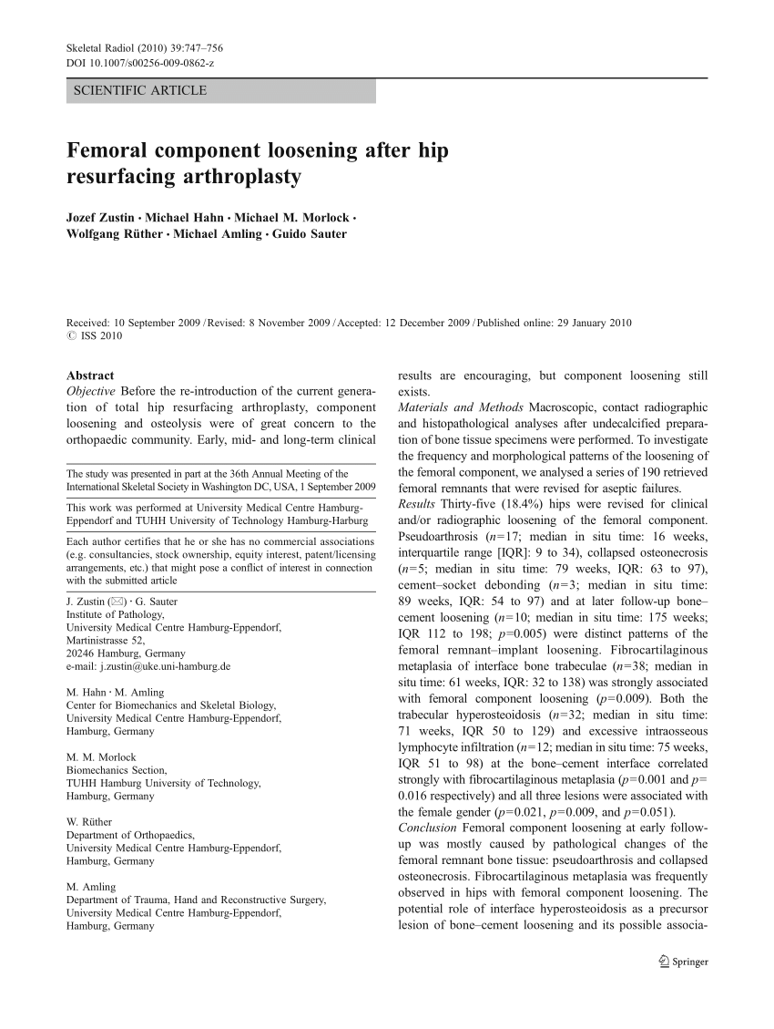 Pdf Femoral Component Loosening After Hip Resurfacing Arthroplasty