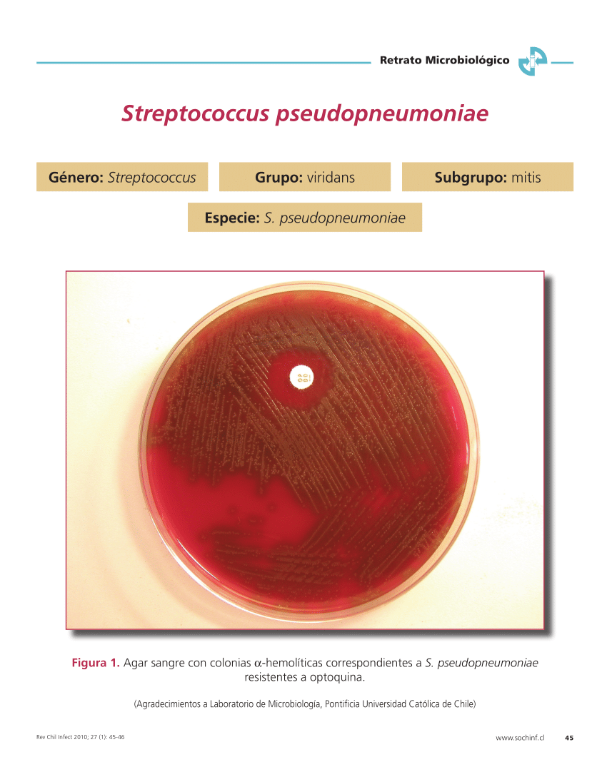 Pdf Streptococcus Pseudopneumoniae