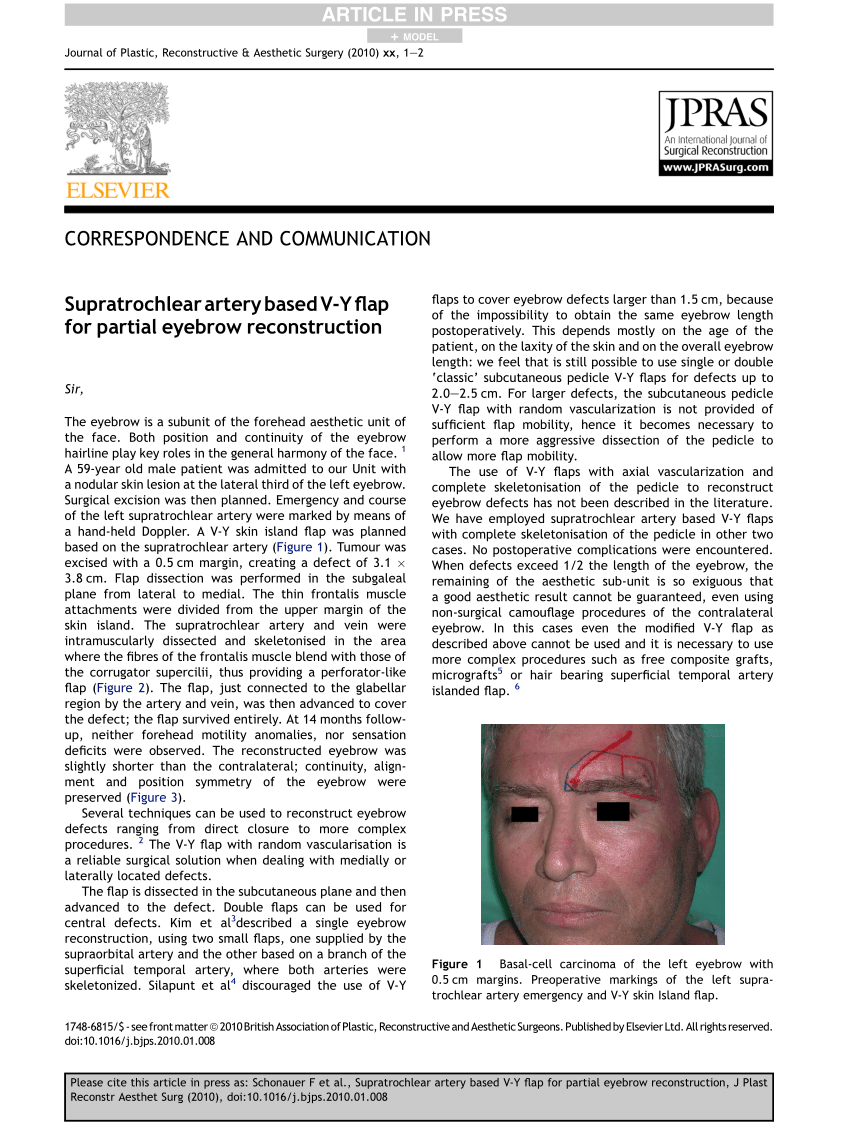 (PDF) Supratrochlear artery based V-Y flap for partial eyebrow ...