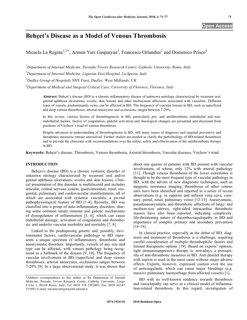 Model de încălțăminte pentru pacienții cu varice