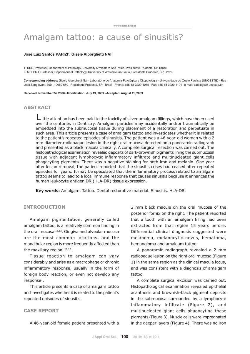 PDF) Amalgam tattoo: a cause of sinusitis? | jose parizi - Academia.edu