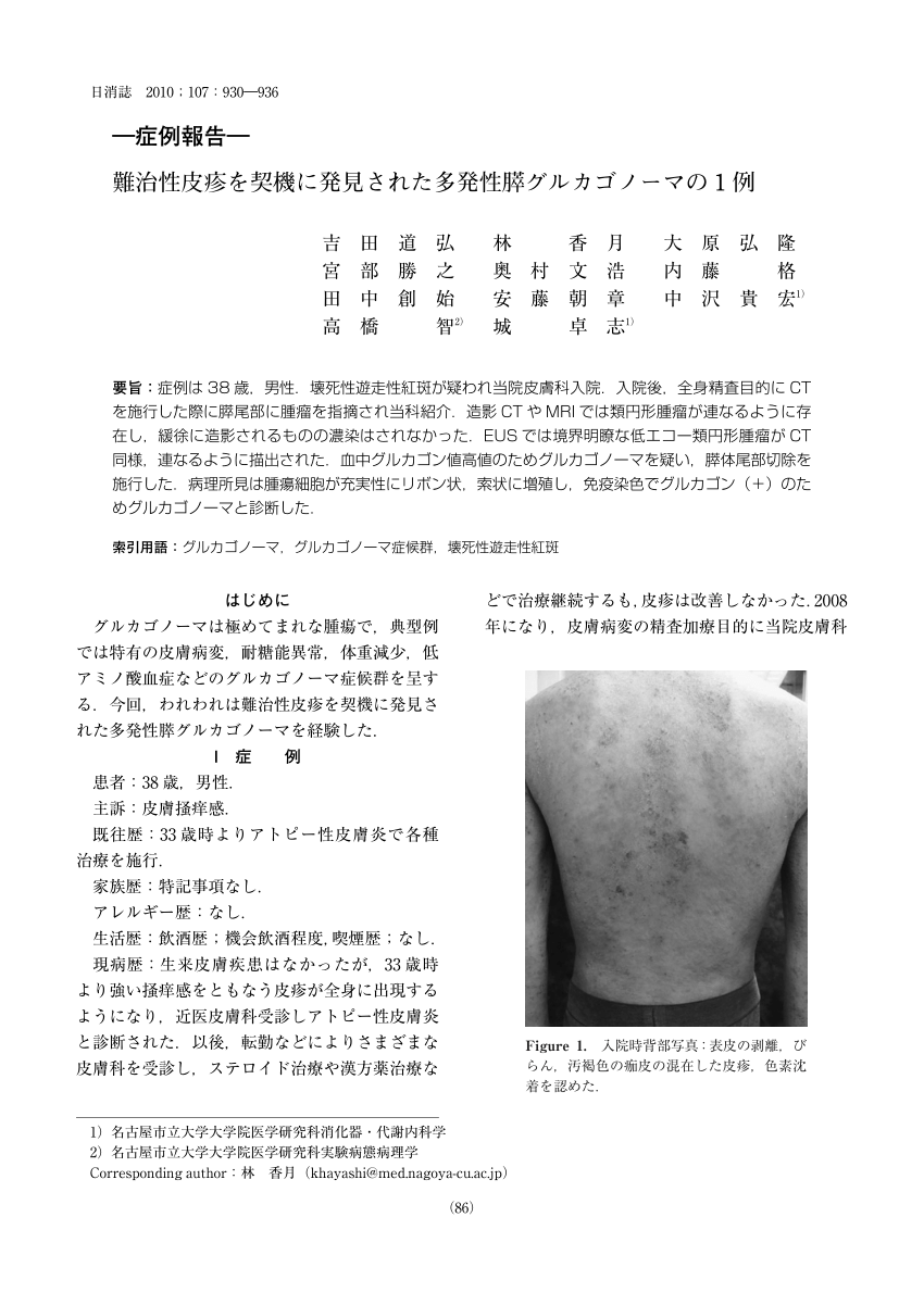 PDF) A case of pancreatic glucagonoma with erythema