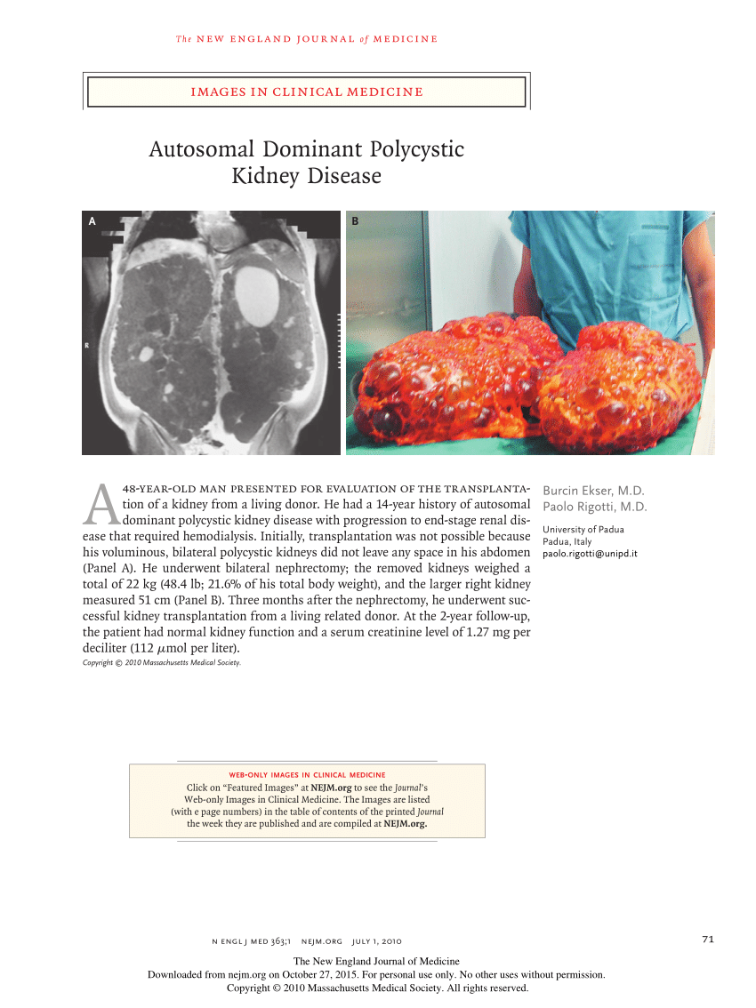 Pdf Autosomal Dominant Polycystic Kidney Disease