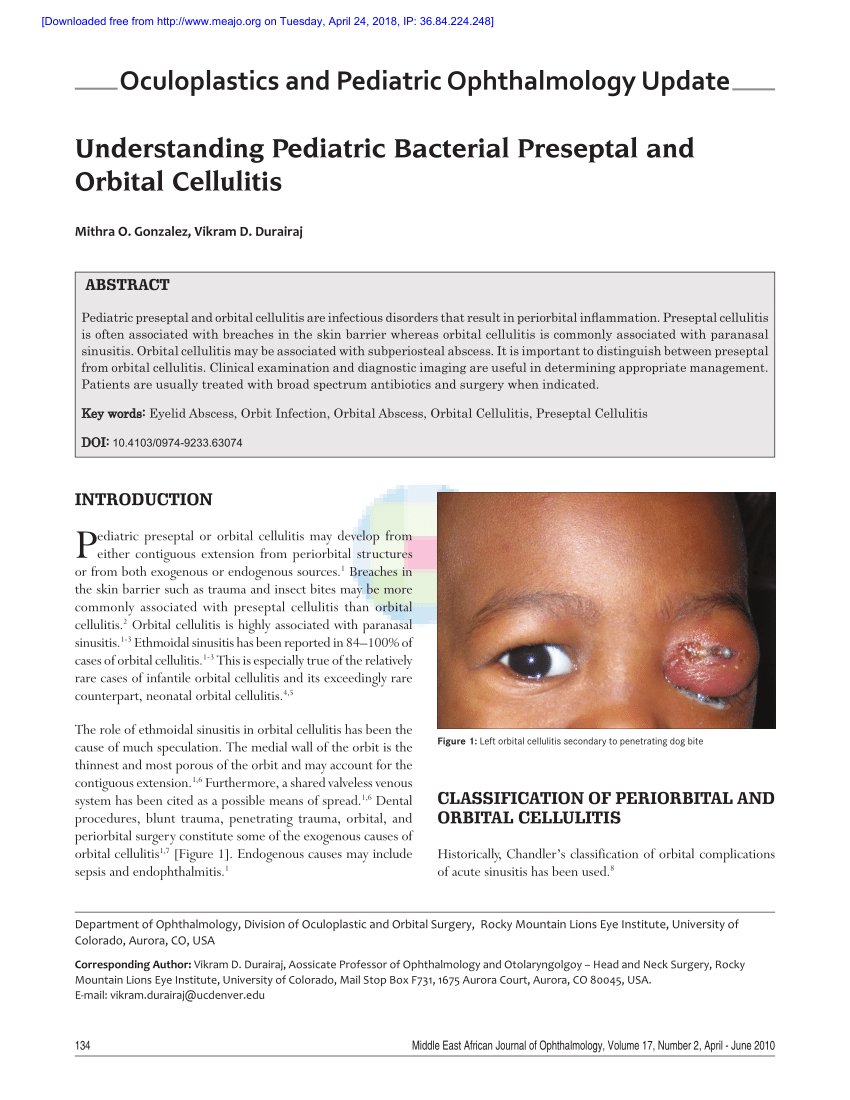 periorbital cellulitis infant