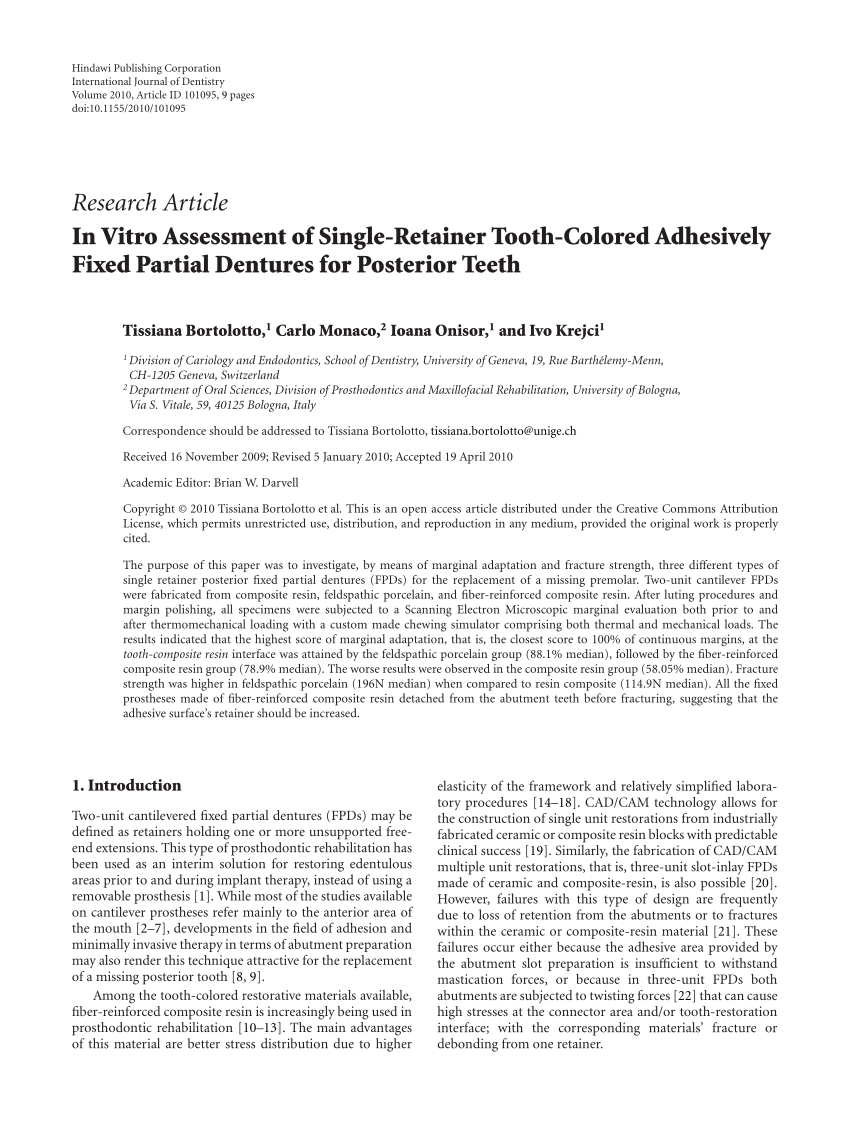 PDF) In Vitro Assessment of Single-Retainer Tooth-Colored ...