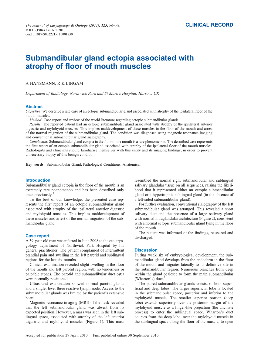 Pdf Submandibular Gland Ectopia Associated With Atrophy Of