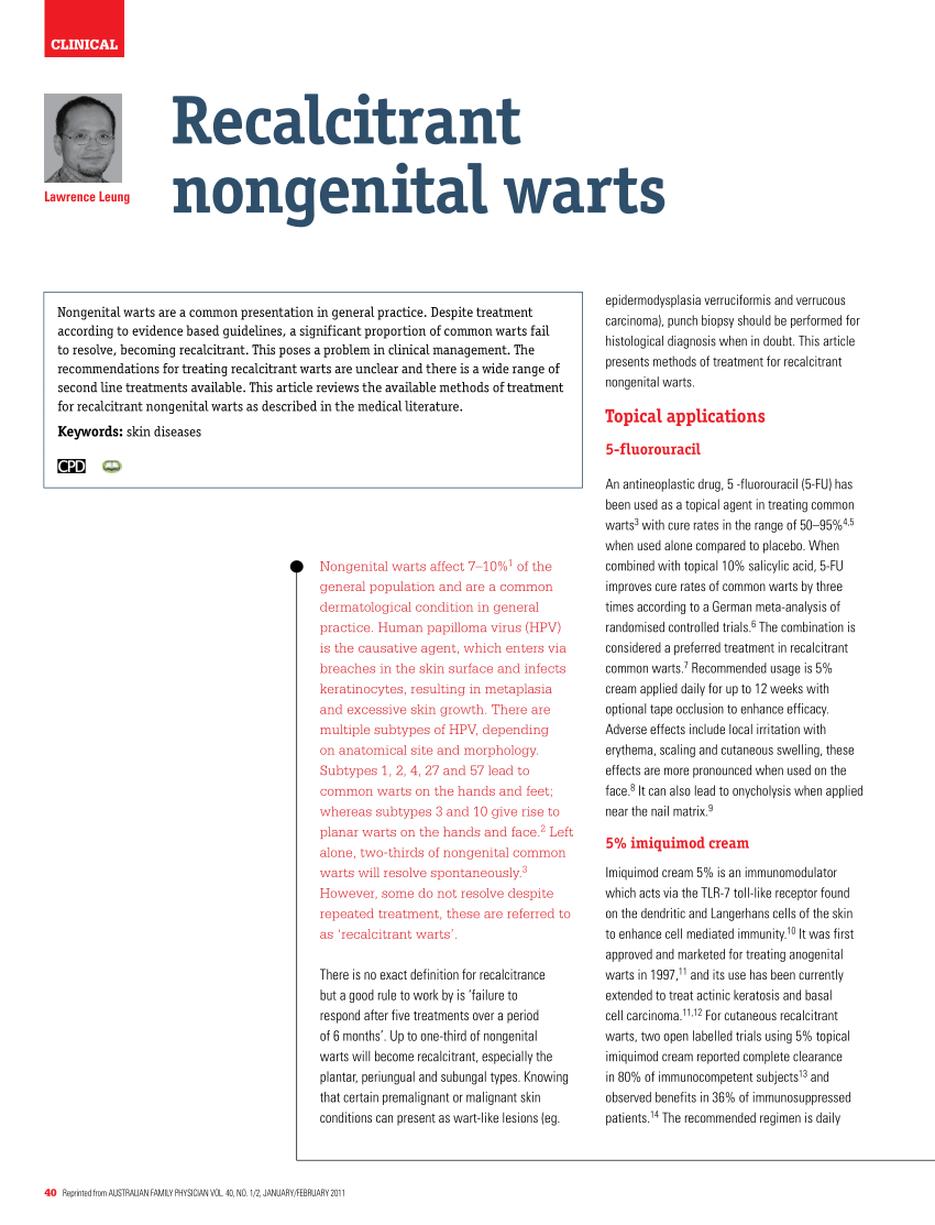 warts treatment guidelines