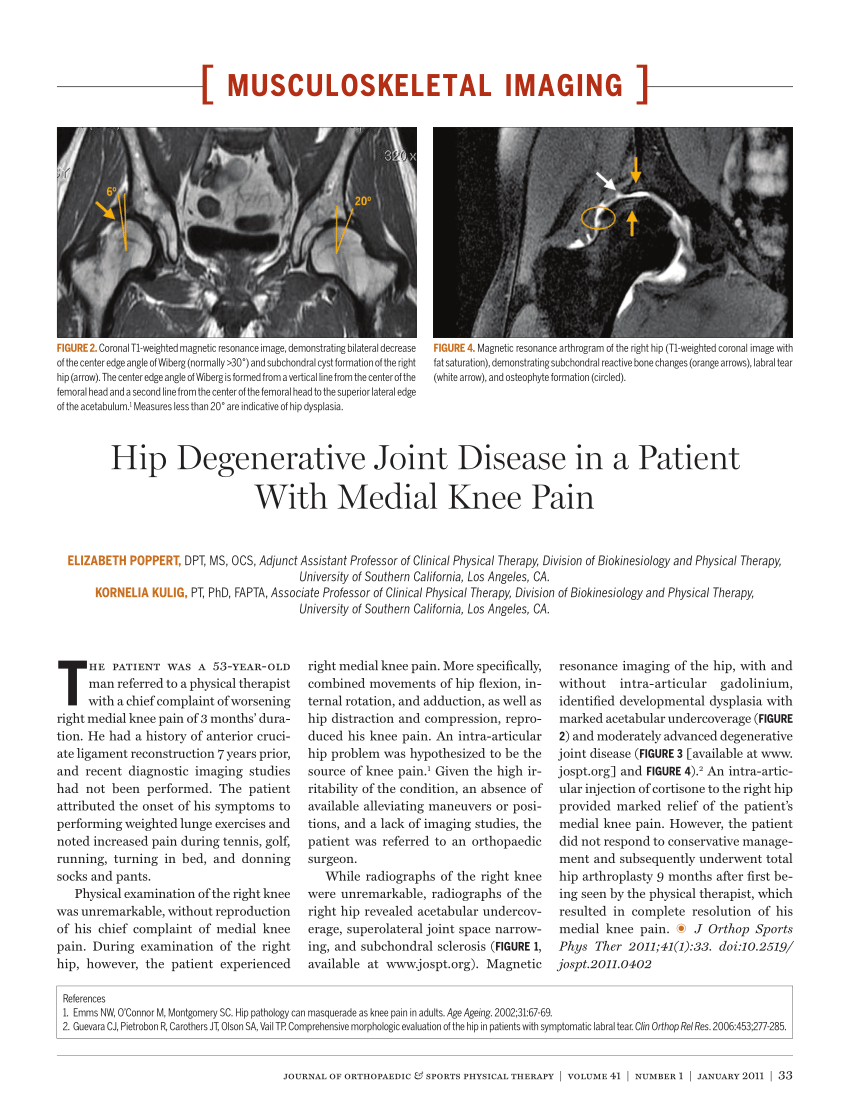 degenerative joint disease research paper