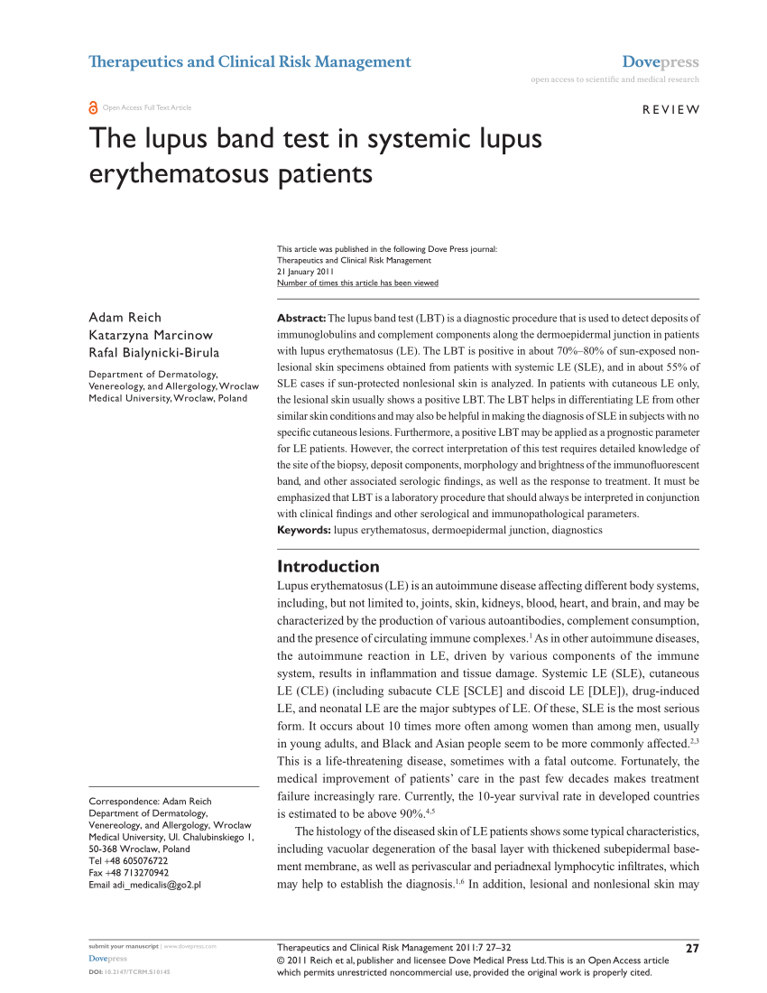 lupus research papers