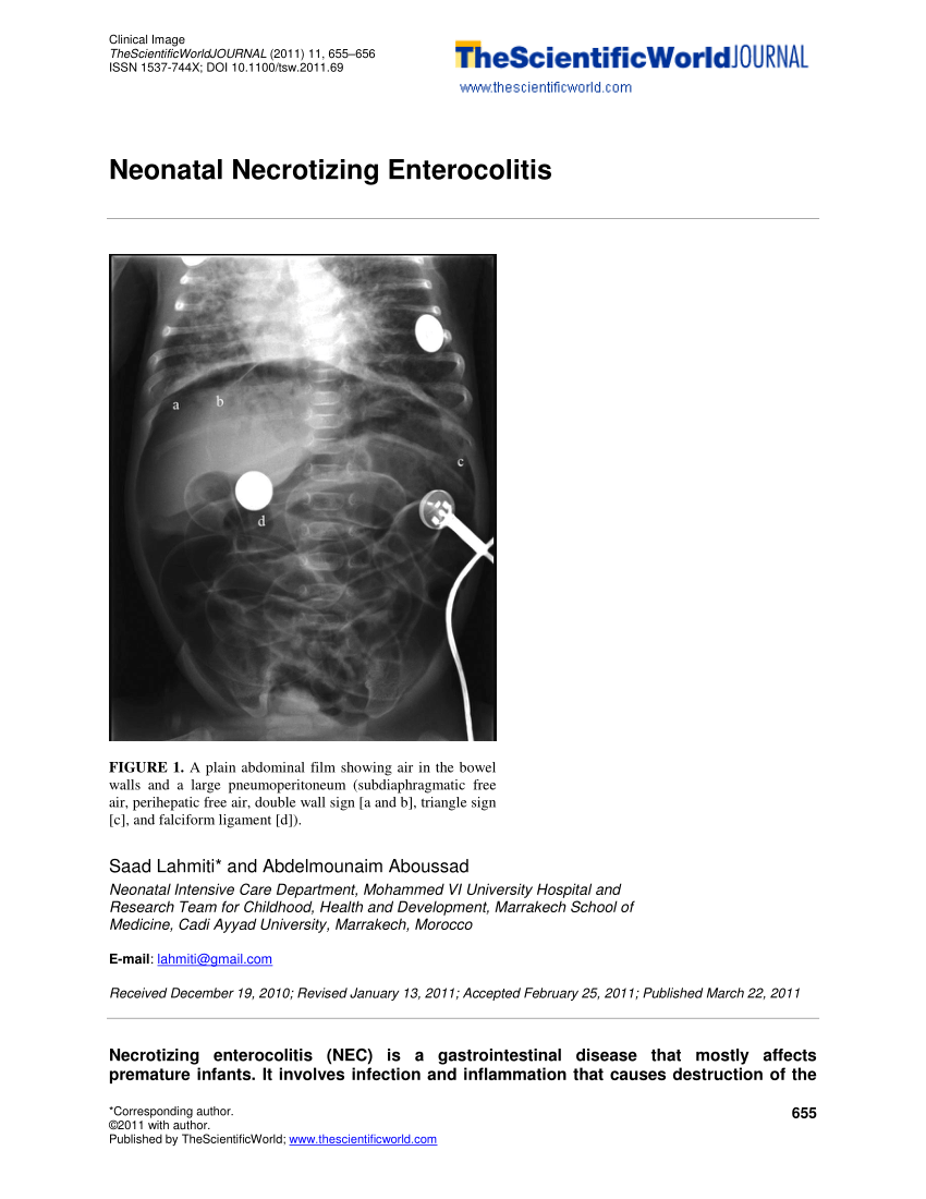 pdf-neonatal-necrotizing-enterocolitis
