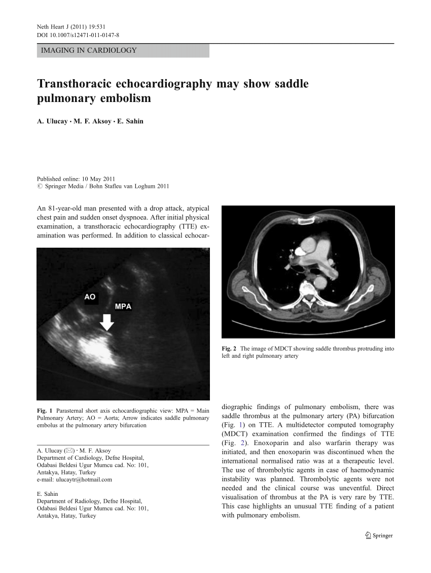 Pdf Transthoracic Echocardiography May Show Saddle Pulmonary Embolism