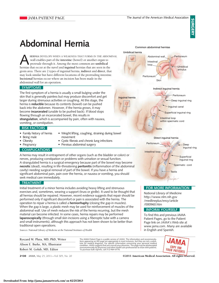 Umbilical hernia: MedlinePlus Medical Encyclopedia Image