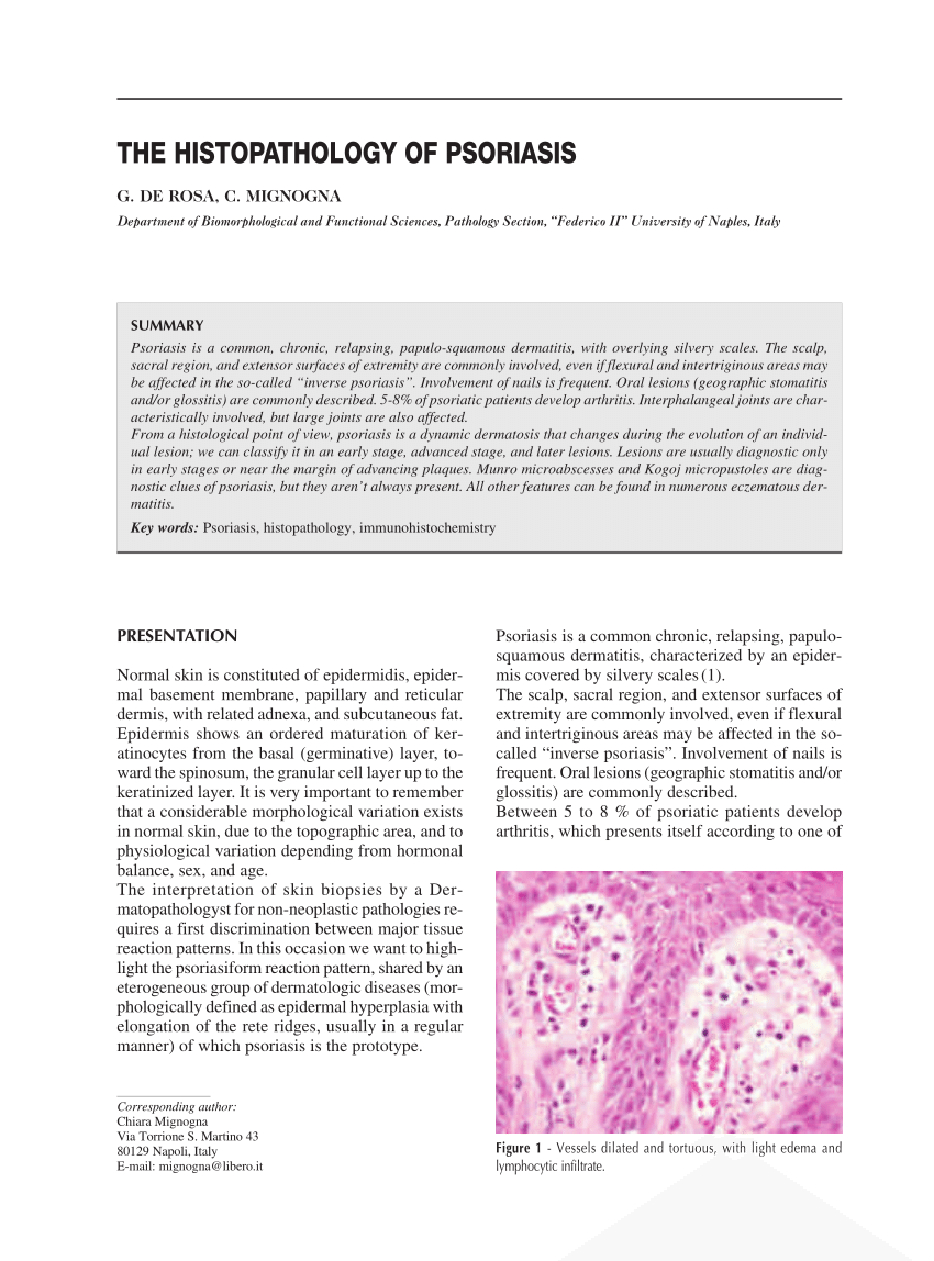 Kis plakk parapsoriasis hisztopathology pdf