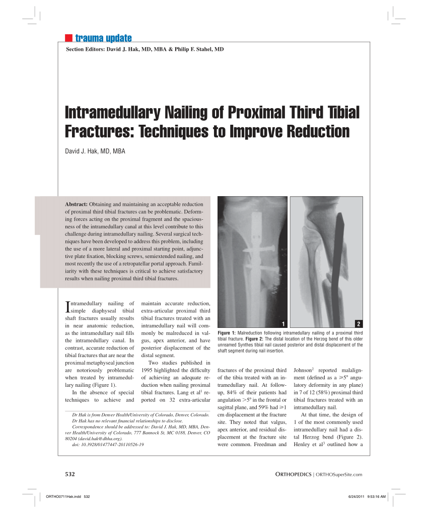 Pdf Intramedullary Nailing Of Proximal Third Tibial Fractures Techniques To Improve Reduction