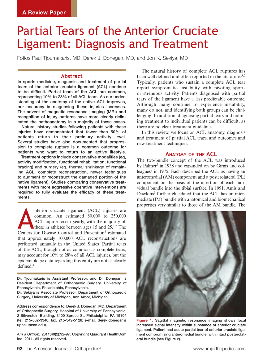 Anterior Cruciate Ligament (ACL) Tear — Southeast Michigan Center for  Orthopedics