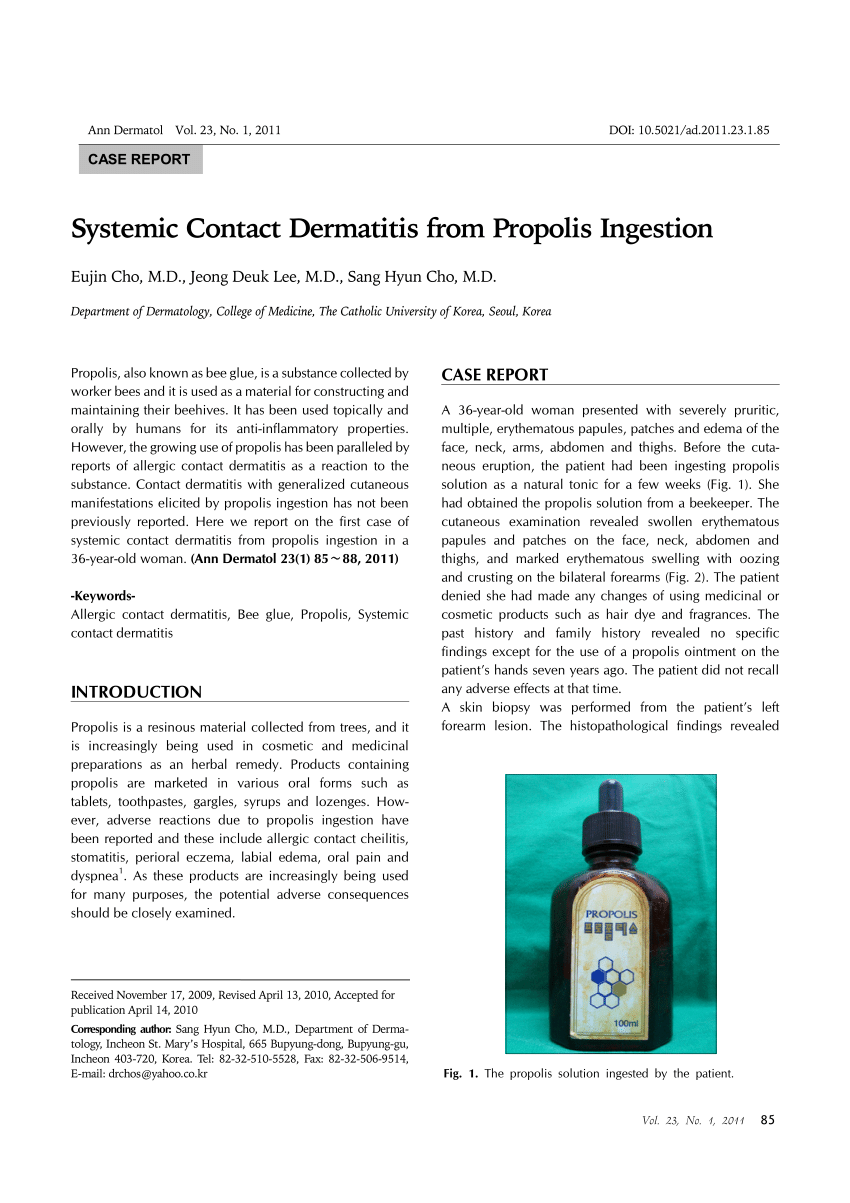 Pdf Systemic Contact Dermatitis From Propolis Ingestion 