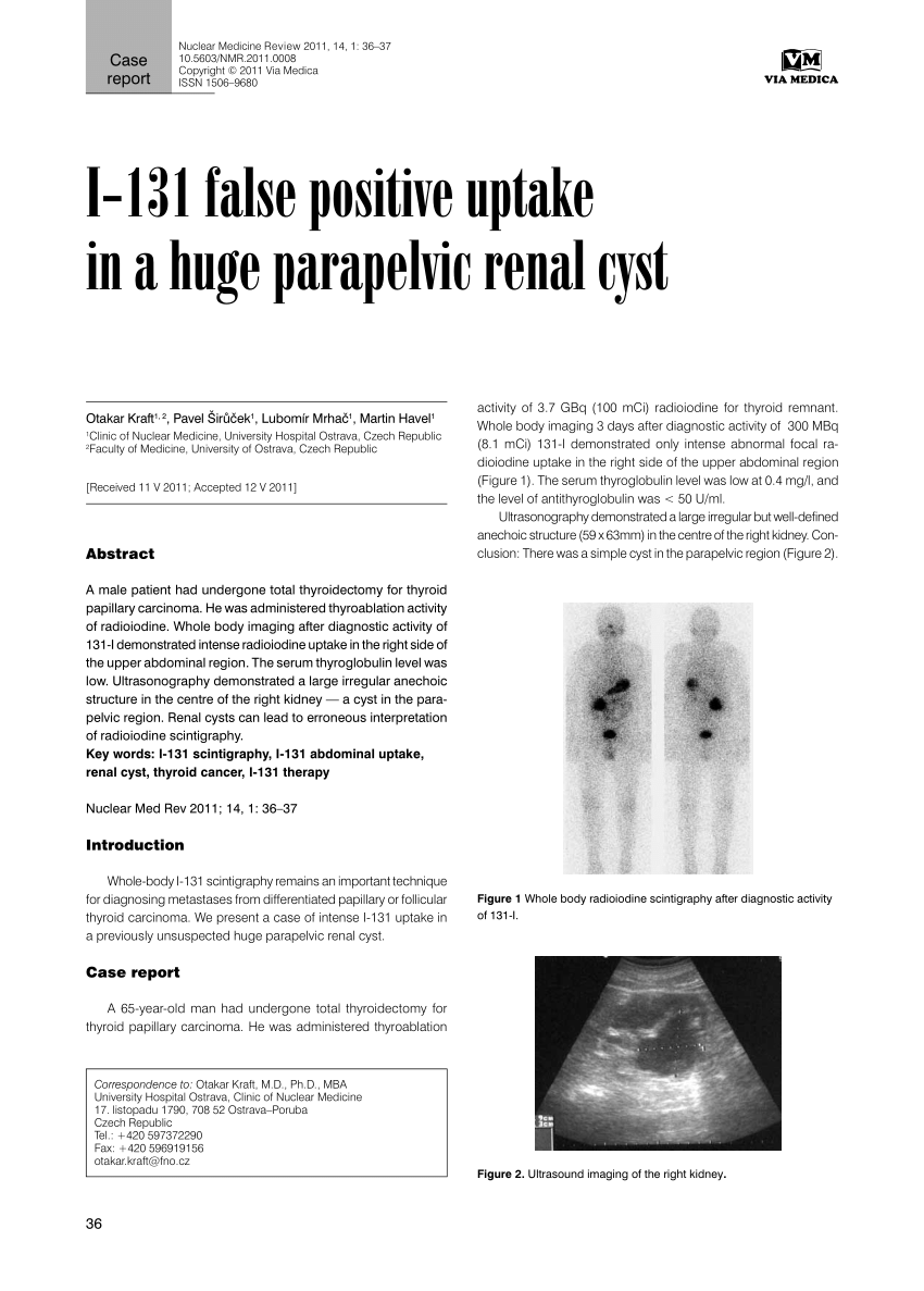 Pdf I 131 False Positive Uptake In A Huge Parapelvic Renal Cyst