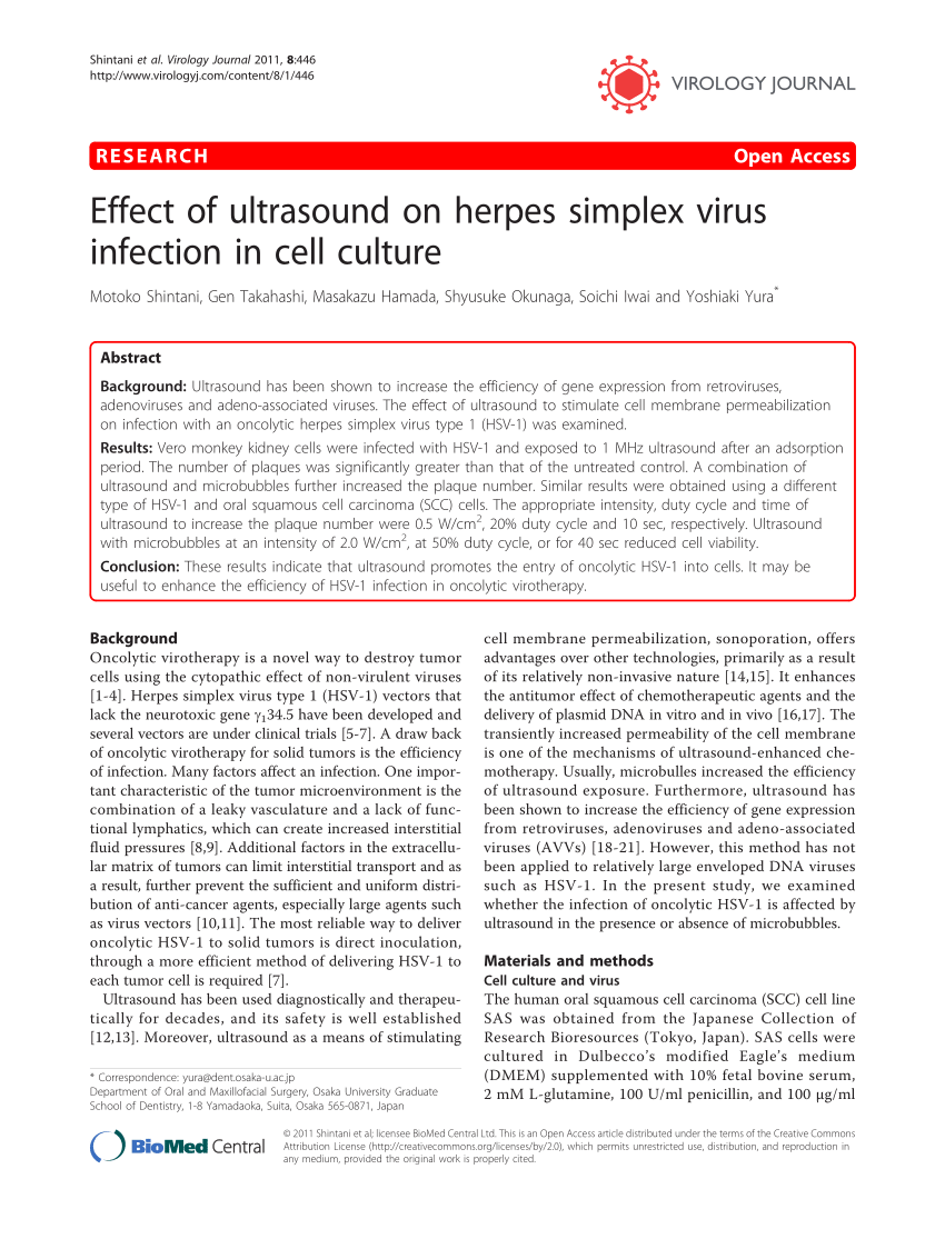 Virus herpes simplex - Wikipedia