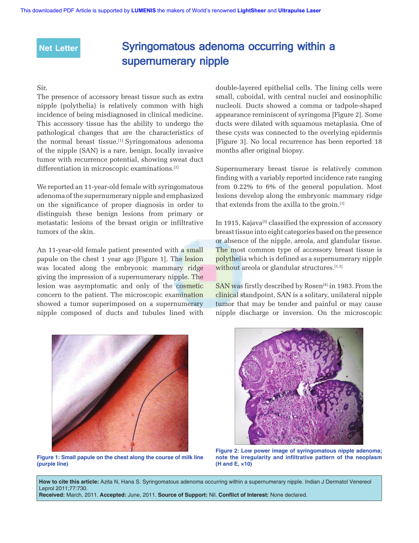 PDF) Syringomatous adenoma occurring within a supernumerary nipple