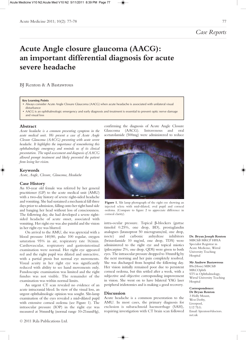 research article on glaucoma