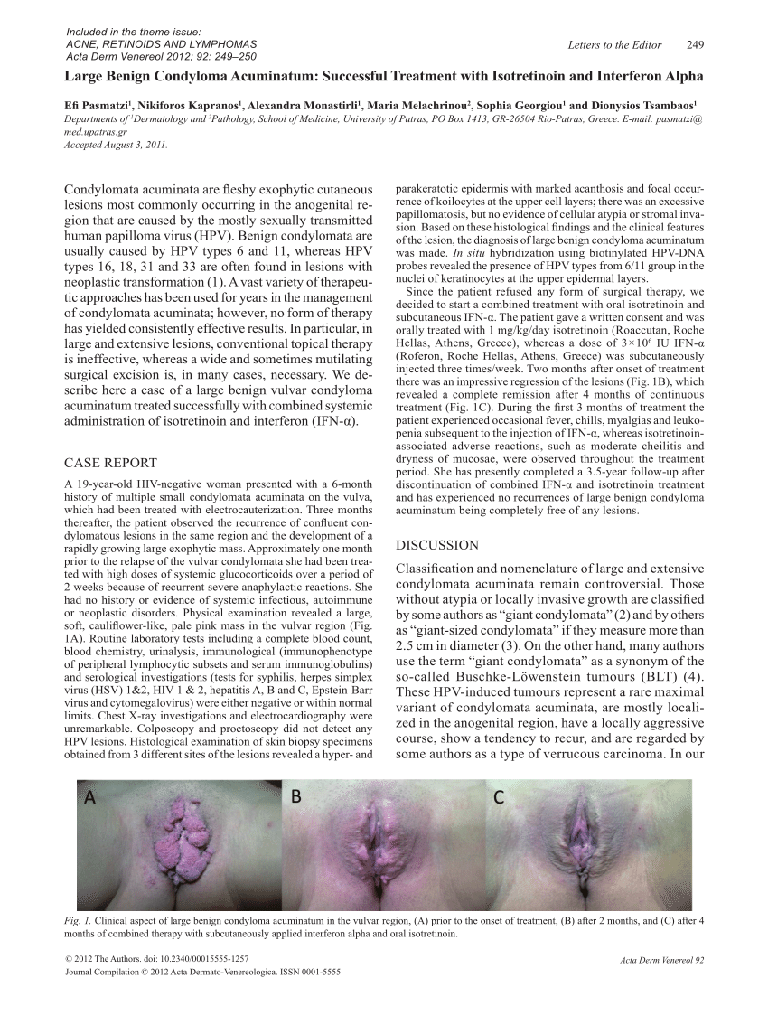 condyloma acuminata icd 9