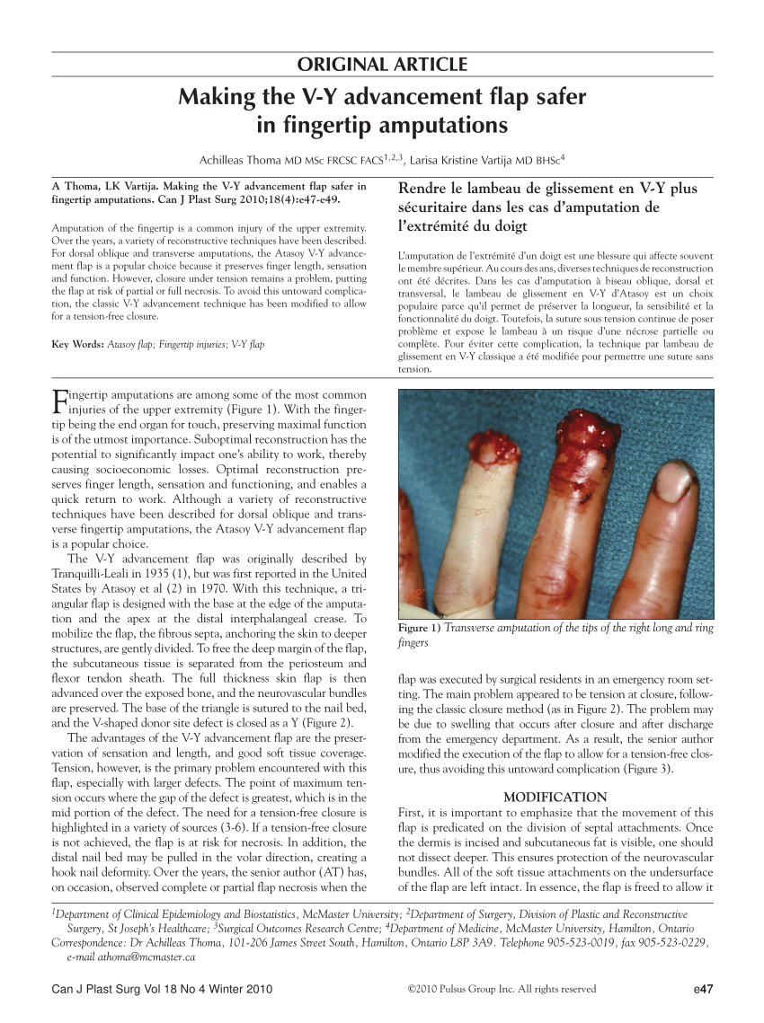 Pdf Making The V Y Advancement Flap Safer In Fingertip Amputations