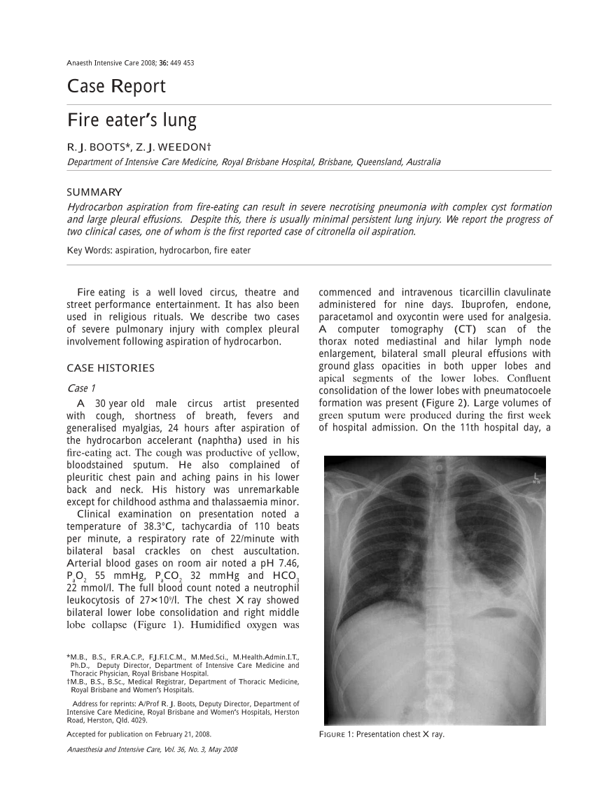 Pdf Fire Eater S Lung