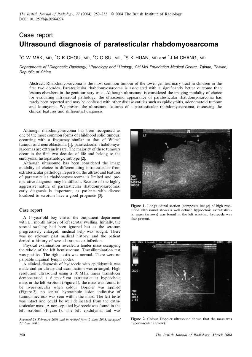 Pdf Ultrasound Diagnosis Of Paratesticular Rhabdomyosarcoma