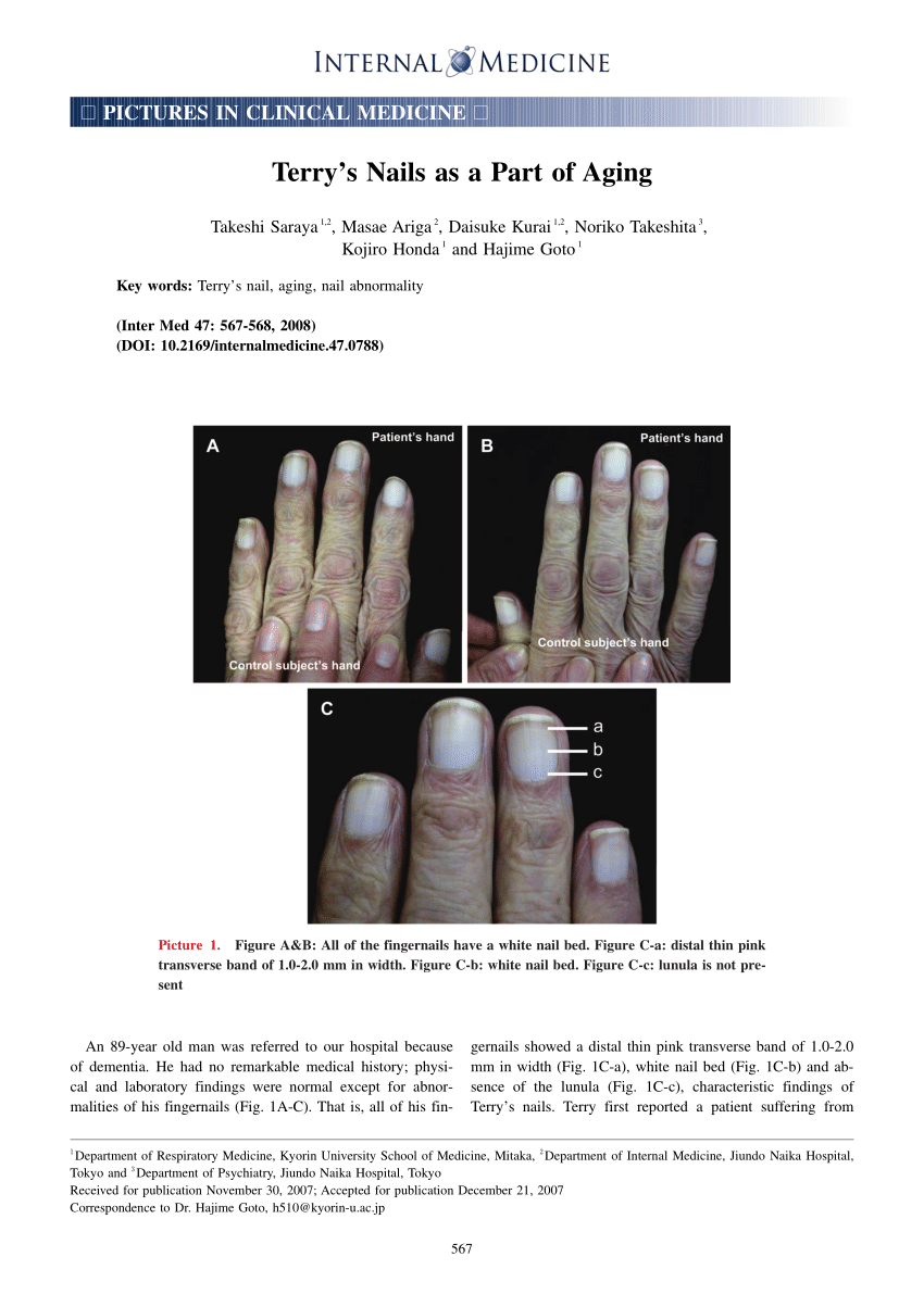 Pdf Terry S Nails As A Part Of Aging