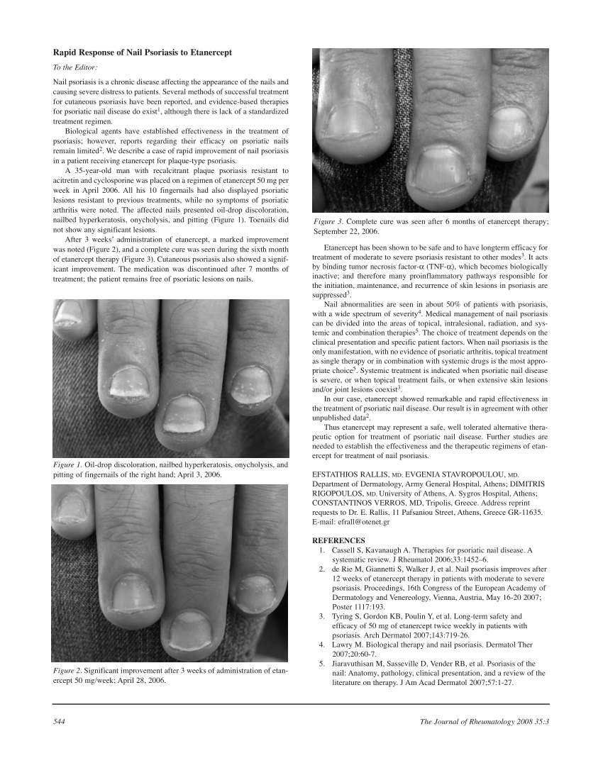 Nail Diseases - Skin Health Institute